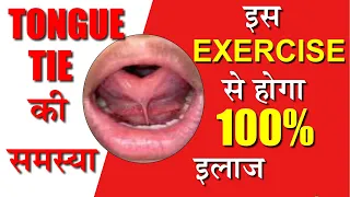 Vocal Exercise | Tongue Tied Problem Stammering Solution  हकलाने तुतलाने का इलाज| Diction Exercises