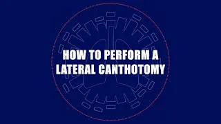 How to Perform a Lateral Canthotomy  An Eye Saving Procedure Every Emergency Physician Should Know