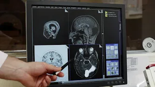 Что делает оператор МРТ или рентген-лаборант?