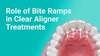 Role of Bite Ramps in Clear Aligner Treatments