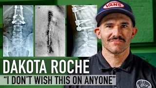 Dakota Roche on his broken back, recovery, and future - UNCLICKED