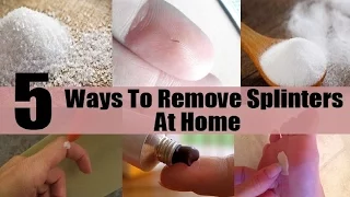 5 Home Remedies to Remove a Splinter Safely | By Top 5.
