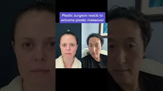 Plastic Surgeon Reacts to Extreme Plastic Surgery Makeover #shorts #plasticsurgery