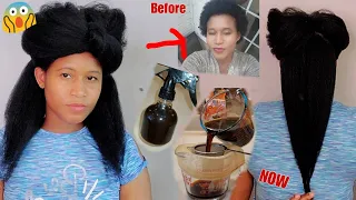 Only one ingredient and your hair will grow like crazy / do not shampoo it out Block DHT & hair fall