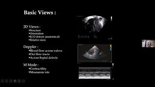 Neonatal Functional ECHO Normal views and how to find ECHO windows