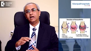 Stages Of Osteoarthritis Of The Knee | Best Orthopedic Doctor in Bangalore|  Manipal Hospitals