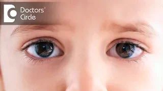 Can one eye be higher than the other How to correct this? - Dr. Elankumaran P