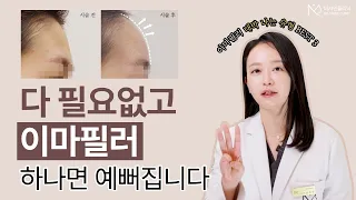 이마필러 하나로 대박 나는 얼굴 BEST 3 (feat. 절대 맞으면 안되는 유형)