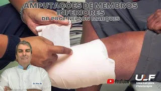 AMPUTAÇÕES DE MEMBROS INFERIORES - Dr. prof. Nelson Marques