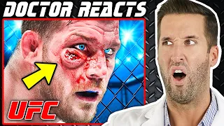 ER Doctor REACTS to Worst MMA Injuries in UFC History