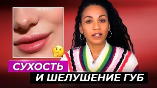 Сухость и шелушение губ: что делать? //Хейлиты: лечение, профилактика, рецепты