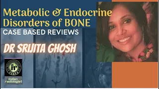 Series of Metabolic & Endocrine Disorders of Bone: Case based Review: DR SRIJITA GHOSH | V1