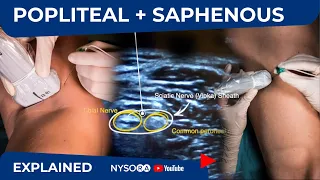 Popliteal + Saphenous blocks for ankle fracture - Regional anesthesia Crash course with Dr. Hadzic