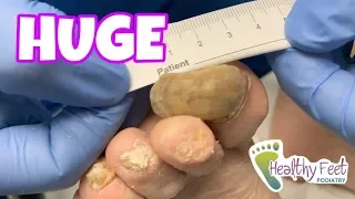 HUGE LONG NAILS TREATMENT