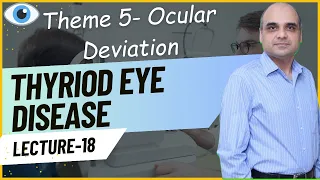 Thyroid Eye Disease Lecture 18