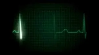 Heartbeat flatline   YouTube