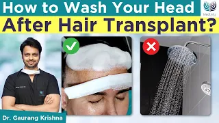 🤷‍♂️How to Wash Your Head After Hair Transplant? Hair wash & Shampoo After Hair Transplant