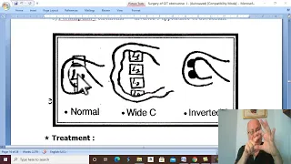 Biliary disorders in Arabic 16 ( Obstructive jaundice , part 4 ) , by Dr. Wahdan