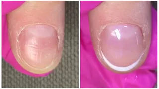 French Shellac Application on Very Short Nails