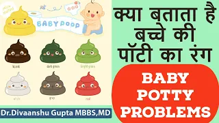 क्या बताता है बच्चे की पॉटी का रंग ,Baby Potty ka colour kya batata hai ,Baby Potty problem in hindi