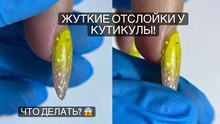 КОШМАРНЫЕ ОТСЛОЙКИ КАК СНИМАТЬ, ЧТОБЫ НЕ ПОВРЕДИТЬ НОГОТЬ?