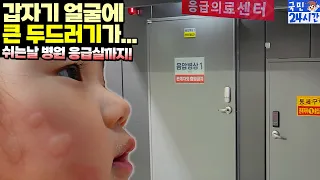 갑자기 국민이 얼굴에 큰 두드러기 나서 병원 응급실 갔어요 ㅠㅠ 왜 쉬는날 꼭 아플까요? 국민이 24시간 급성 알레르기 아이랑 가족 흔한 일상 | 말이야와친구들