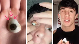 What It's Like To Have A Prosthetic Eye