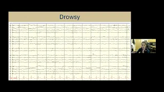 Understanding EEG: A Practical Guide for Patients and Families