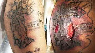 Man dies from septic shock after swimming with new tattoo;Man rams glass inside his body -06/08/2017