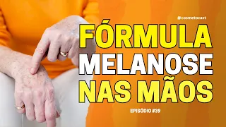 FÓRMULA PARA MELANOSE NAS MÃOS: CONSULTÓRIO E HOME CARE I CosmetoCast #39 #podcast