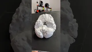 3D tisk - Lidský mozek