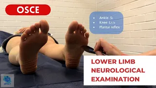 OSCE Video Series: Lower Limb Neurological Examination | Teaching for Impact