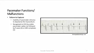 Pacemaker Overview
