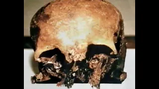 Overkill (Bog Bodies Documentary, 1998)