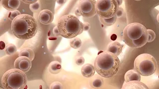 Leukemia, Lymphoma, and Multiple Myeloma