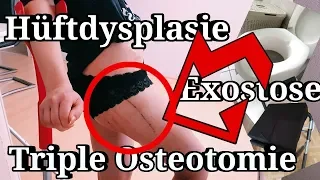 Triple Osteotomie , Übungen? Toilette? selbstständig aus dem Bett? 2  post