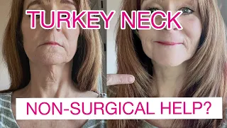 Sagging Neck?| Improve Saggy Neck Wrinkles without Surgery | Over 50 |