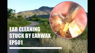 Ear cleaning stuck by ear-wax eps-01