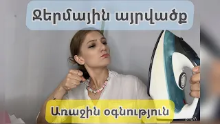 Ջերմային այրվածքներ։ Առաջին օգնություն