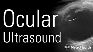 Ocular Ultrasound