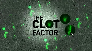 Full Measure: September 10, 2023 - The Clot Factor