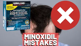 5 BIGGEST MISTAKES When Using Minoxidil REVEALED