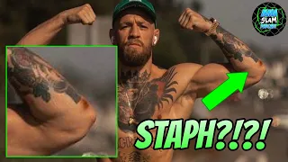 Does Conor McGregor have Staph ahead of Poirier Fight?