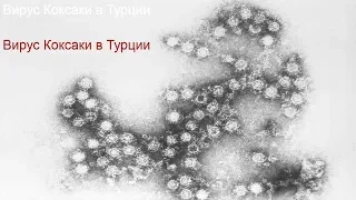 Вирус Коксаки в Турции - мнение медиков