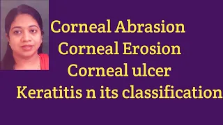 Classification of keratitis/what is corneal abrasion/corneal erosion/keratitis and corneal ulcer