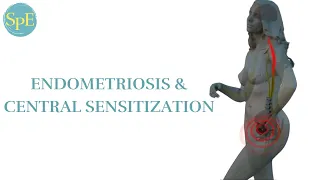 Video 3: Endometriosis & Central Sensitization