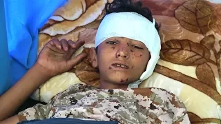 No End in Sight for US-Backed Yemen War as Airstrike Kills At Least 20, Including Bride, at Wedding