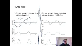 Ventilator Graphics