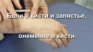 Боли в кисти и запястье, онемение в кисти.