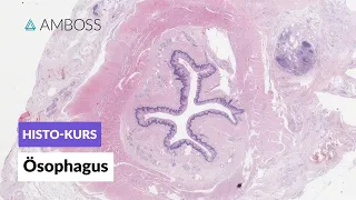 Histologie Ösophagus - Mikroskopische Anatomie - AMBOSS Video